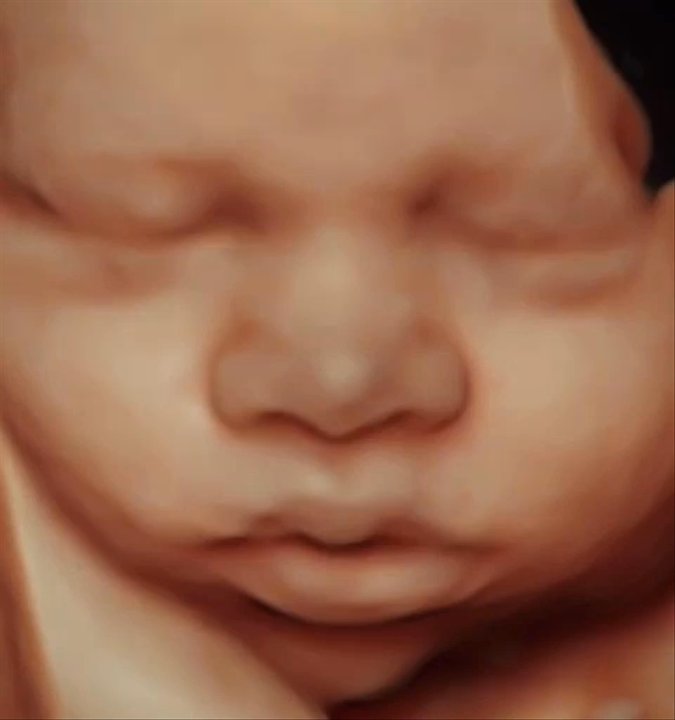 New Life Imaging - 5D HD live to 8k enjoy the Saturday service. Choose your image for upgrade and enjoy a more realistic view of the things to come. - Ultrasound Imaging Centers Near Me - Stuart, Florida