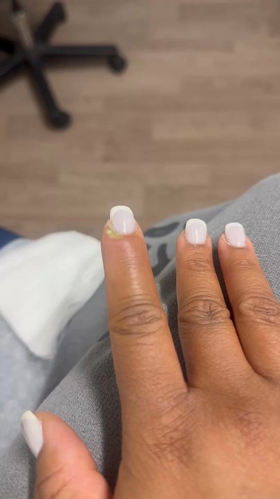 Nails On 5th - My Doctor draining infection from nails on 5th - Nail Salons Near Me - Austin, Texas