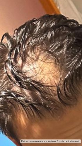 Hair Boost